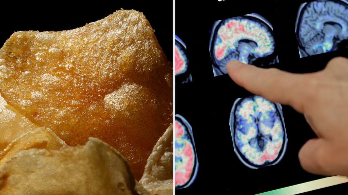 Study Links Ultra-Processed Foods to Signs of Brain Injury in Canadians