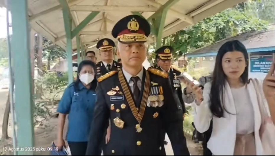 Kapolda Babel Jenguk Korban Penyiraman Air Keras di RS Bhakti Wara