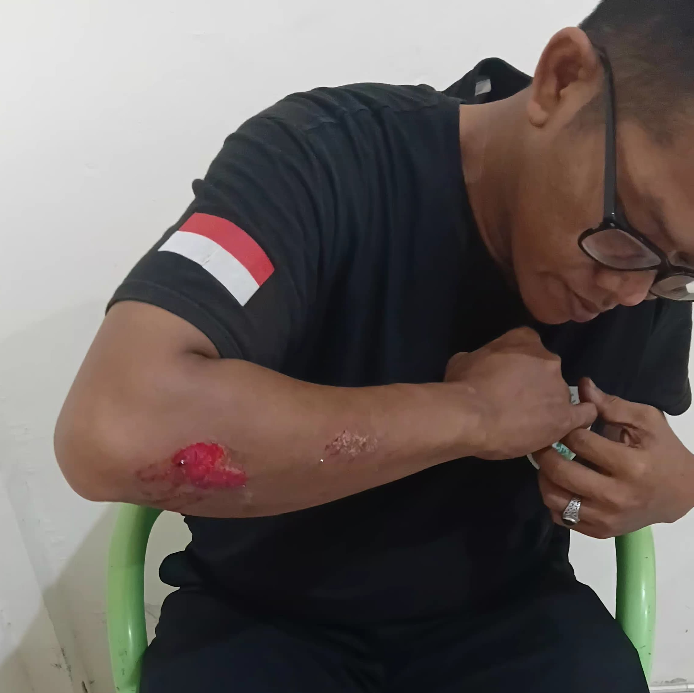 Deki Jadi Korban Tumpahan Solar di Simpang 4 Ramayana Pangkalpinang, Warga