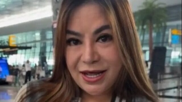 Anisa Bahar 5 Kali Operasi Hidung, Segini Biaya yang Dikeluarkan