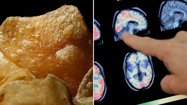 Study Links Ultra-Processed Foods to Signs of Brain Injury in Canadians